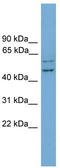 RAB11 Family Interacting Protein 2 antibody, TA334557, Origene, Western Blot image 