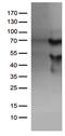 Kruppel Like Factor 11 antibody, CF810999, Origene, Western Blot image 