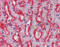 Solute carrier family 2, facilitated glucose transporter member 2 antibody, TA317322, Origene, Immunohistochemistry frozen image 