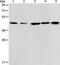 Acetyl-CoA Acyltransferase 2 antibody, PA5-50293, Invitrogen Antibodies, Western Blot image 