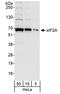 Eukaryotic Translation Initiation Factor 2A antibody, A301-949A, Bethyl Labs, Western Blot image 