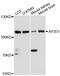 Adaptor Related Protein Complex 3 Subunit Delta 1 antibody, A13058, ABclonal Technology, Western Blot image 