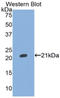 Inter-alpha-trypsin inhibitor heavy chain H5 antibody, LS-C294709, Lifespan Biosciences, Western Blot image 