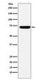 Zinc Finger And BTB Domain Containing 7A antibody, M03081, Boster Biological Technology, Western Blot image 