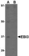 Epstein-Barr Virus Induced 3 antibody, TA306701, Origene, Western Blot image 