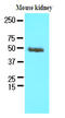 Proteasome 26S Subunit, Non-ATPase 11 antibody, AM09082PU-N, Origene, Western Blot image 