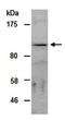Zinc Finger E-Box Binding Homeobox 2 antibody, orb66987, Biorbyt, Western Blot image 