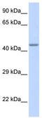 Zinc Finger Protein 589 antibody, TA331931, Origene, Western Blot image 