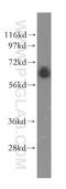 Glycerophosphodiester Phosphodiesterase 1 antibody, 11272-2-AP, Proteintech Group, Western Blot image 