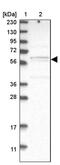 Chromosome 17 Open Reading Frame 53 antibody, PA5-54788, Invitrogen Antibodies, Western Blot image 