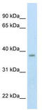 Zinc Finger MYND-Type Containing 11 antibody, TA337298, Origene, Western Blot image 