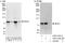 Interleukin 1 Receptor Associated Kinase 1 antibody, A303-743A, Bethyl Labs, Immunoprecipitation image 