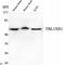 Transducin Beta Like 1 X-Linked Receptor 1 antibody, LS-C813132, Lifespan Biosciences, Western Blot image 