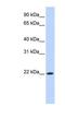 Deleted In Primary Ciliary Dyskinesia Homolog (Mouse) antibody, NBP1-55201, Novus Biologicals, Western Blot image 