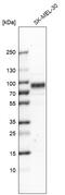 Tyrosinase Related Protein 1 antibody, HPA000937, Atlas Antibodies, Western Blot image 