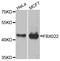 F-Box Protein 22 antibody, A09447, Boster Biological Technology, Western Blot image 