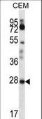 Retinoic Acid Receptor Responder 1 antibody, LS-C162446, Lifespan Biosciences, Western Blot image 