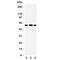 Solute Carrier Family 1 Member 1 antibody, R31285, NSJ Bioreagents, Western Blot image 