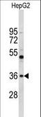 ELOVL Fatty Acid Elongase 2 antibody, LS-C167736, Lifespan Biosciences, Western Blot image 
