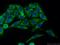 Fumarate Hydratase antibody, 11375-1-AP, Proteintech Group, Immunofluorescence image 
