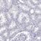 LOR antibody, NBP2-62700, Novus Biologicals, Immunohistochemistry paraffin image 