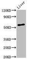 Adhesion Molecule With Ig Like Domain 2 antibody, CSB-PA769765LA01HU, Cusabio, Western Blot image 