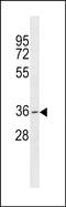 Growth Differentiation Factor 5 Opposite Strand antibody, PA5-49040, Invitrogen Antibodies, Western Blot image 