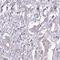 Leucine Rich Repeat Containing 9 antibody, NBP2-34177, Novus Biologicals, Immunohistochemistry paraffin image 