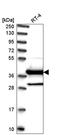 DnaJ Heat Shock Protein Family (Hsp40) Member C22 antibody, HPA039953, Atlas Antibodies, Western Blot image 