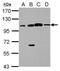FA Core Complex Associated Protein 100 antibody, PA5-30832, Invitrogen Antibodies, Western Blot image 