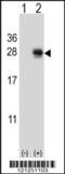 Pro-Melanin Concentrating Hormone antibody, 61-963, ProSci, Western Blot image 