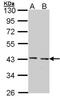 5 -AMP-activated protein kinase catalytic subunit alpha-2 antibody, orb73997, Biorbyt, Western Blot image 