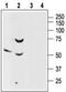 Sst2 antibody, TA329053, Origene, Western Blot image 