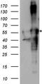 Transforming Growth Factor Beta 1 Induced Transcript 1 antibody, TA890151, Origene, Western Blot image 