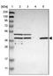 Solute Carrier Family 22 Member 23 antibody, PA5-53214, Invitrogen Antibodies, Western Blot image 
