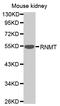RNA Guanine-7 Methyltransferase antibody, MBS128090, MyBioSource, Western Blot image 