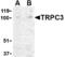 Short transient receptor potential channel 3 antibody, TA306347, Origene, Western Blot image 