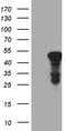 3-ketoacyl-CoA thiolase A, peroxisomal antibody, M07559, Boster Biological Technology, Western Blot image 
