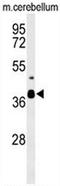 Divergent Protein Kinase Domain 2A antibody, AP50748PU-N, Origene, Western Blot image 