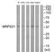 Mitochondrial Ribosomal Protein S31 antibody, TA315035, Origene, Western Blot image 