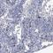 F-Box And WD Repeat Domain Containing 12 antibody, HPA037492, Atlas Antibodies, Immunohistochemistry frozen image 