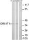 Olfactory Receptor Family 51 Subfamily T Member 1 antibody, A30881, Boster Biological Technology, Western Blot image 