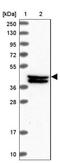 Family With Sequence Similarity 217 Member B antibody, NBP1-94080, Novus Biologicals, Western Blot image 