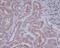 Hyaluronan And Proteoglycan Link Protein 1 antibody, M05980-1, Boster Biological Technology, Immunohistochemistry paraffin image 