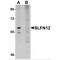 Schlafen Family Member 12 antibody, MBS150371, MyBioSource, Western Blot image 