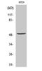 VANGL Planar Cell Polarity Protein 1 antibody, A07587-1, Boster Biological Technology, Western Blot image 