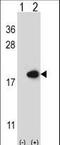 Fatty Acid Binding Protein 2 antibody, LS-C165911, Lifespan Biosciences, Western Blot image 