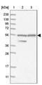 Heparan-Alpha-Glucosaminide N-Acetyltransferase antibody, NBP1-81990, Novus Biologicals, Western Blot image 