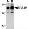 RPA-interacting protein antibody, MBS150388, MyBioSource, Western Blot image 