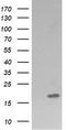 Cancer/Testis Antigen 1B antibody, CF505958, Origene, Western Blot image 